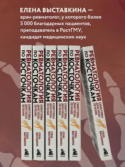Ревматология по косточкам. Симптомы, диагнозы, лечение - фото 5