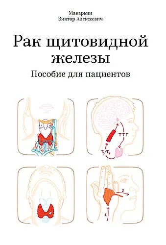 Рак щитовидной железы. Пособие для пациентов - фото 1