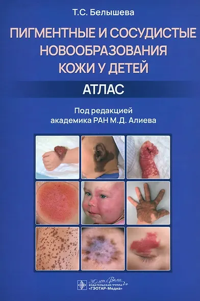 Пигментные и сосудистые новообразования кожи у детей. Атлас - фото 1