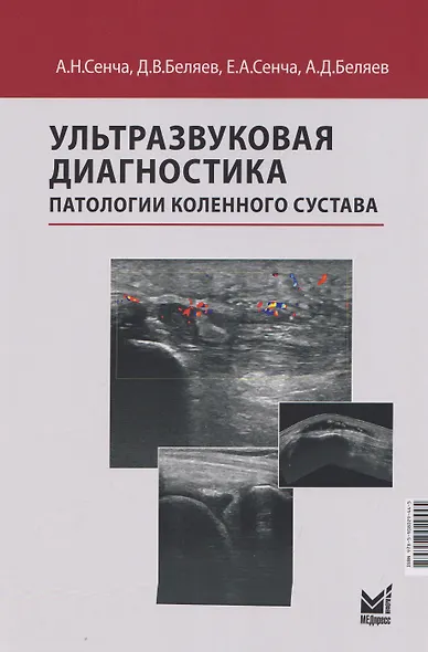 Ультразвуковая диагностика патологии коленного сустава - фото 1