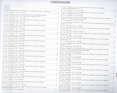 Атлас электроэнцефалограмм детей - фото 2