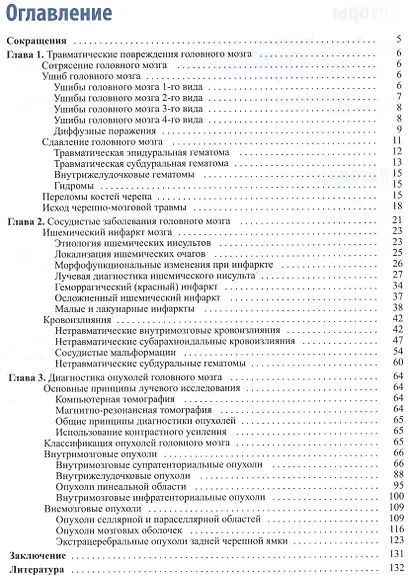 Лучевая диагностика заболеваний головного мозга - фото 2
