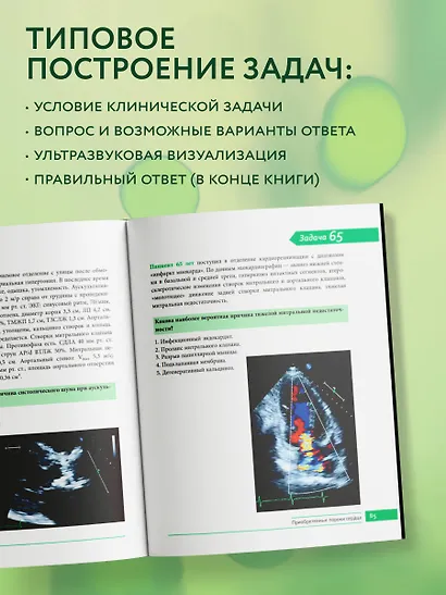 Клинические задачи по эхокардиографии - фото 8