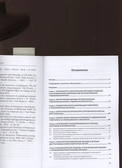 Хирургические вмешательства в комплексном лечении туберкулеза легких. Предоперационное планирование - фото 2