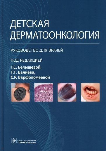 Детская дерматоонкология. Руководство для врачей - фото 1