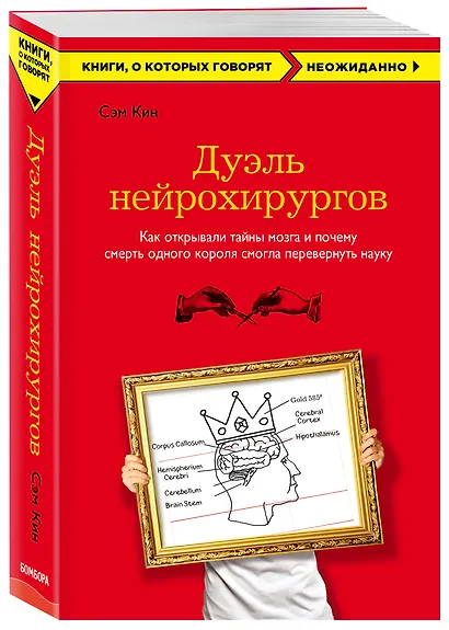 Дуэль нейрохирургов. Как открывали тайны мозга, и почему смерть одного короля смогла перевернуть науку - фото 3
