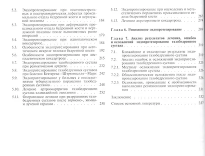 Эндопротезирование при ранениях, повреждениях и заболеваниях тазобедренного сустава: Руководство для врачей - фото 3