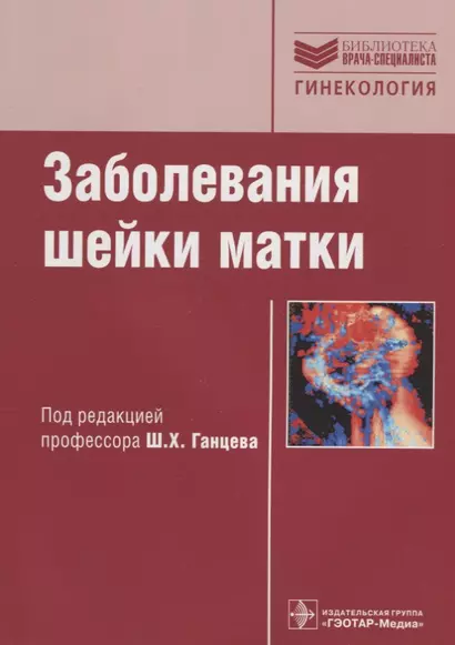 Заболевания шейки матки: руководство - фото 1