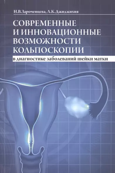 Современные и инновационные возможности кольпоскопии в диагностике заболеваний шейки матки - фото 1