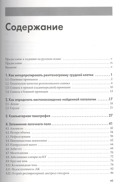 Рентгенография грудной клетки - фото 2
