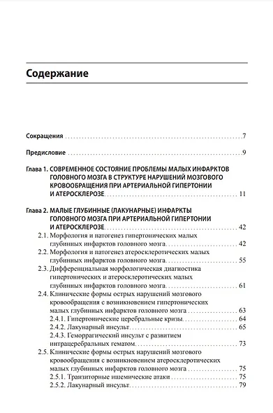 Малые инфаркты головного мозга - фото 2