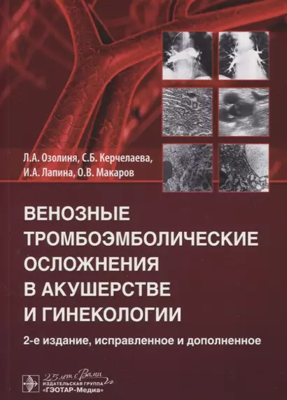 Венозные тромбоэмболические осложнения в акушерстве и гинекологии - фото 1