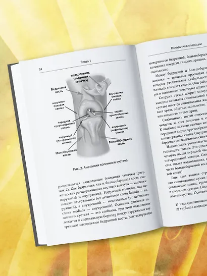 Эндопротезирование коленного сустава: ответы практикующего врача на все вопросы пациентов - фото 11