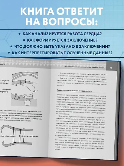 Эхокардиография для начинающих. Суть гемодинамических нарушений, позиции для анализа, определение тяжести порока - фото 6