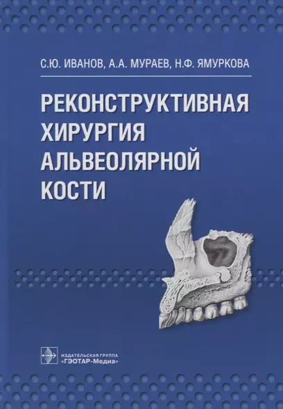 Реконструктивная хирургия альвеолярной кости. - фото 1