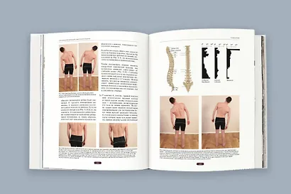 Фасциальный релиз для структурного баланса - фото 8