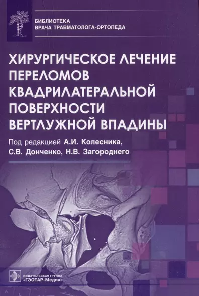 Хирургическое лечение переломов квадрилатеральной поверхности вертлужной впадины - фото 1