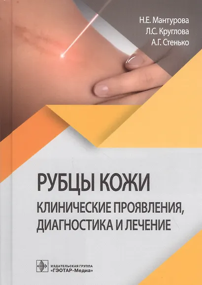 Рубцы кожи. Клинические проявления, диагностика и лечение - фото 1