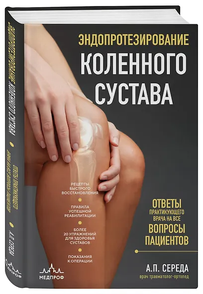 Эндопротезирование коленного сустава: ответы практикующего врача на все вопросы пациентов - фото 3