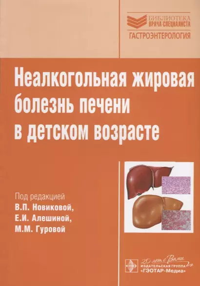 Неалкогольная жировая болезнь печени в детском возрасте. - фото 1