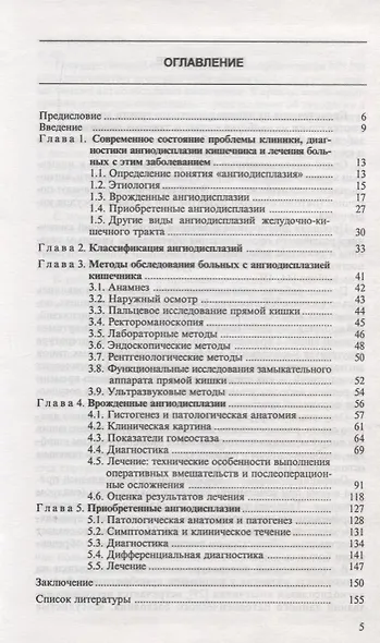 Ангиодисплазии кишечника - фото 2