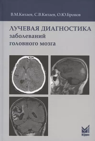 Лучевая диагностика заболеваний головного мозга. 3-е издание - фото 1