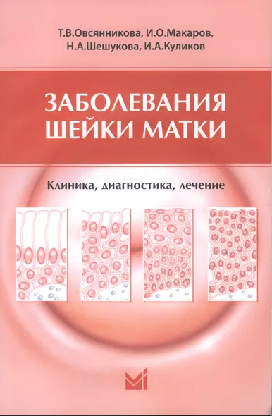 Заболевания шейки матки. Клиника, диагностика, лечение: учеб. пособие - фото 1