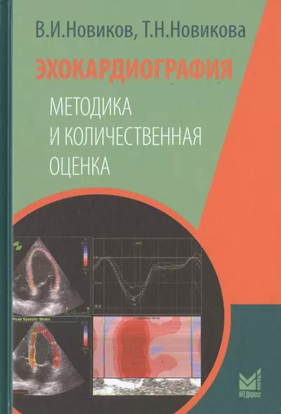 Эхокардиография. Методика и количественная оценка - фото 1