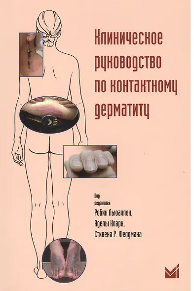 Клиническое руководство по контактному дерматиту - фото 1
