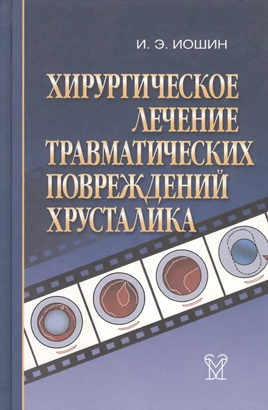 Хирургическое лечение травматических повреждений хрусталика - фото 1