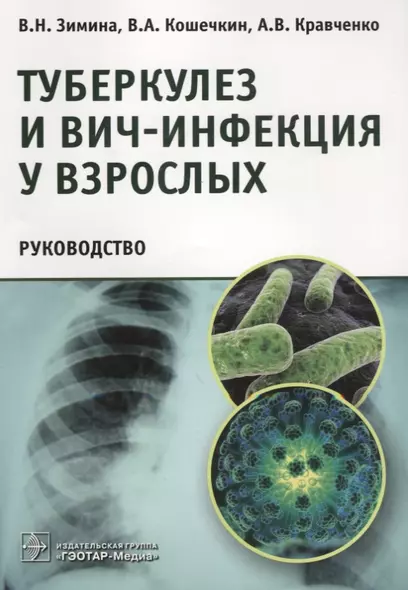 Туберкулез и ВИЧ-инфекция у взрослых. Руководство - фото 1