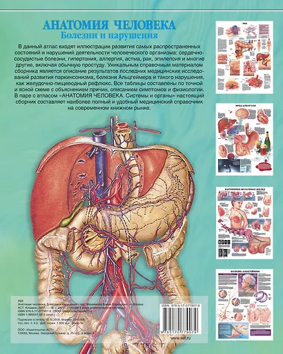 Атлас анатомии человека. Болезни и нарушения - фото 2