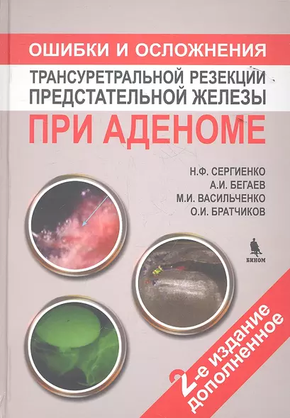 Ошибки и осложнения трансуретральной резекции предстательной железы при аденоме. 2 -е изд.доп. - фото 1