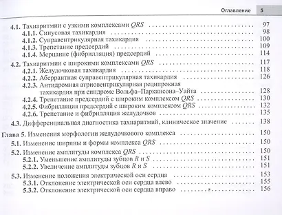 Электрокардиограмма: основы дифференциальной диагностики - фото 4