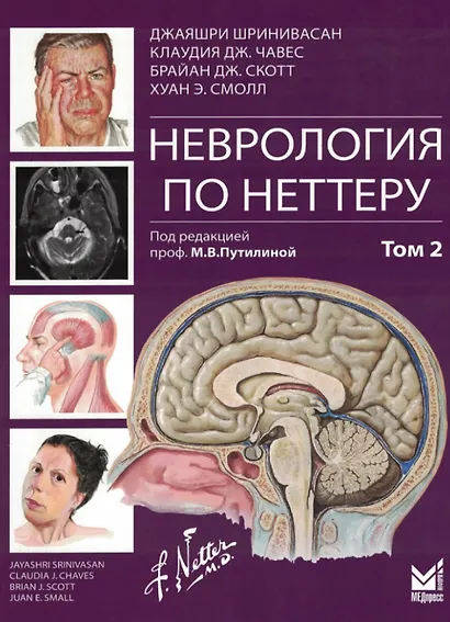 Неврология по Неттеру. Том 2 - фото 1