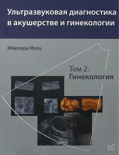 Ультразвуковая диагностика в акушерстве и гинекологии. Т.2. - фото 1