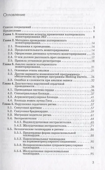 Холтеровское мониторирование ЭКГ: возможности, трудности, ошибки - фото 2