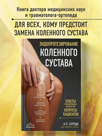 Эндопротезирование коленного сустава: ответы практикующего врача на все вопросы пациентов - фото 4