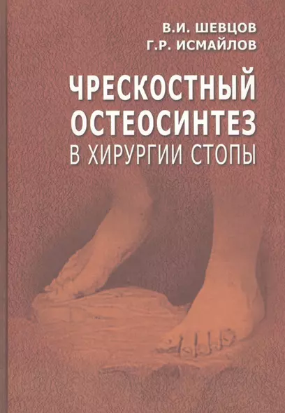 Чрескостный остеосинтез в хирургии стопы. Руководство для врачей - фото 1