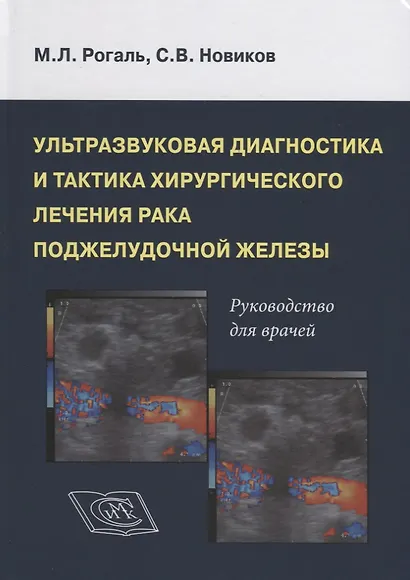 Ультрозвуковая диагностика и тактика хирургического лечения рака поджелудочной железы. Руководство для врачей - фото 1