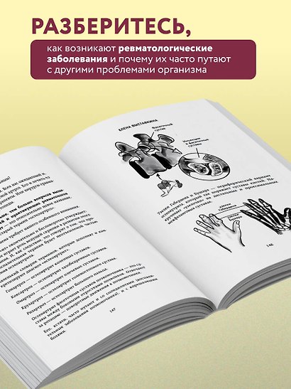 Ревматология по полочкам. Сопутствующие болезни, осложнения и запутанные случаи - фото 6