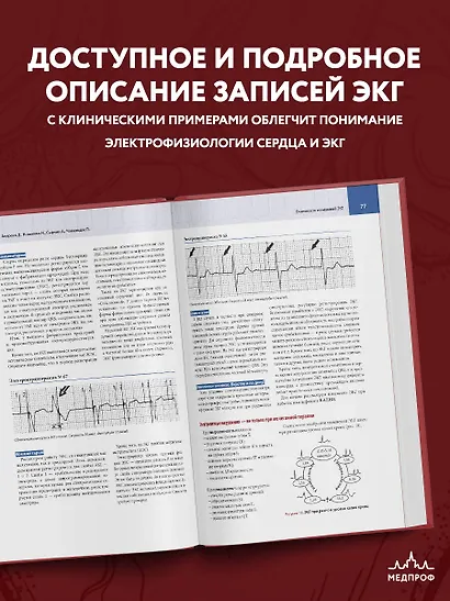 Атлас электрокардиографии. Интерпретация результатов: от простого к сложному - фото 6