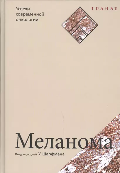 Меланома. Серия «Успехи современной онкологии» № 1. - фото 1