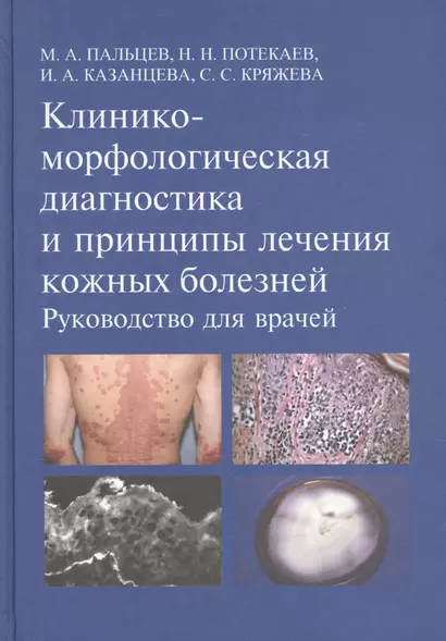 Клинико-морфологическая диагностика и принципы лечения кожных болезней. Руководство для врачей - фото 1