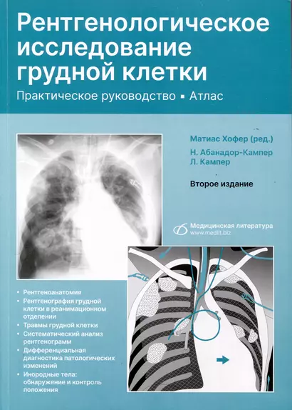 Рентгенологическое исследование грудной клетки. Практическое руководство. Атлас - фото 1