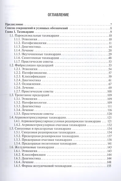 Аритмии сердца - фото 2