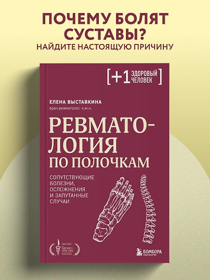 Ревматология по полочкам. Сопутствующие болезни, осложнения и запутанные случаи - фото 4
