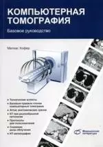 Компьютерная томография Базовое руководство / 2-е изд. - фото 1