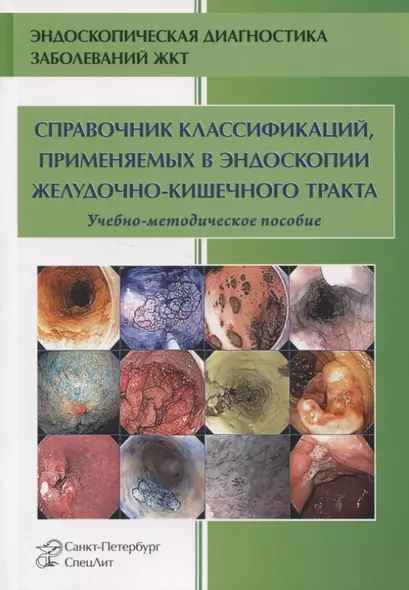 Справочник классификаций, применяемых в эндоскопии желудочно-кишечного тракта - фото 1