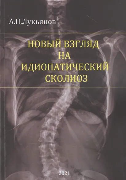 Новый взгляд на идиопатический сколиоз - фото 1